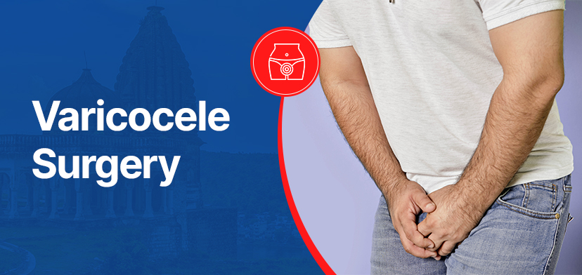 Varicocele Surgery