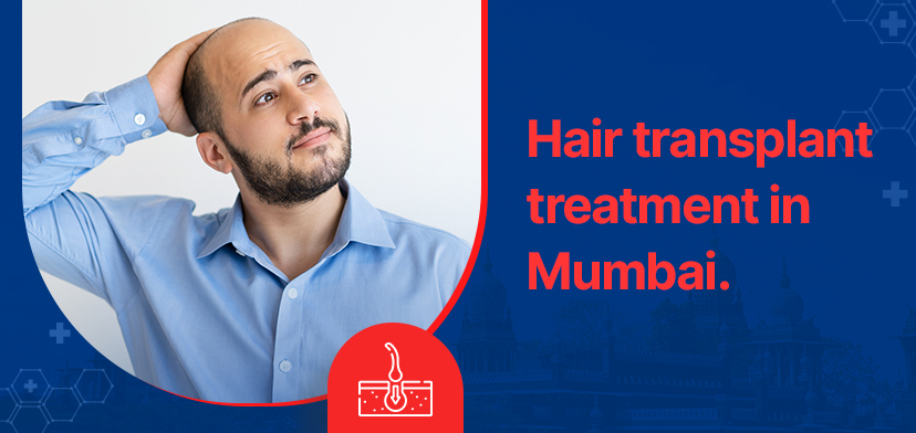 Pain free hair transplant treatment in Mumbai – Pay with no-cost EMI