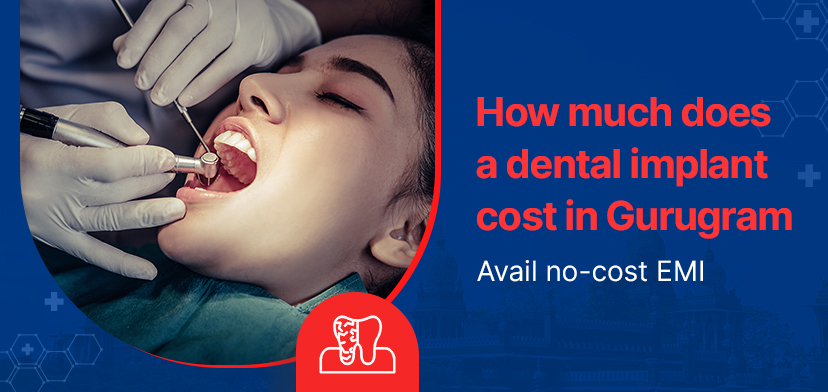 How Much Does A Dental Implant Cost In Gurugram – Avail No-Cost EMI