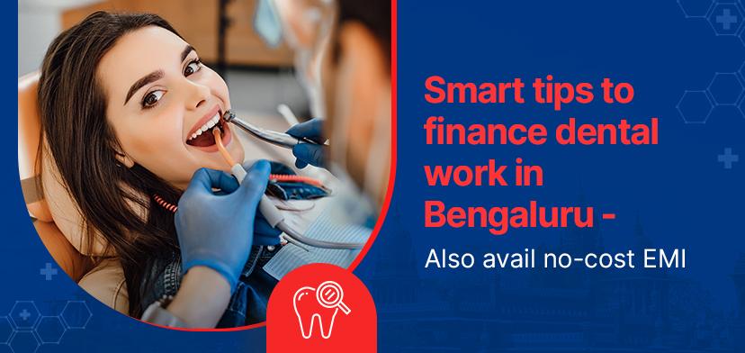 Smart Tips To Finance Dental Work In Bengaluru – Also Avail No-Cost EMI