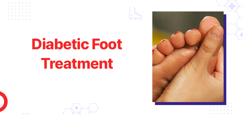 Diabetic Foot Treatment