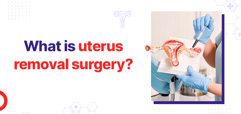 uterus removal surgery