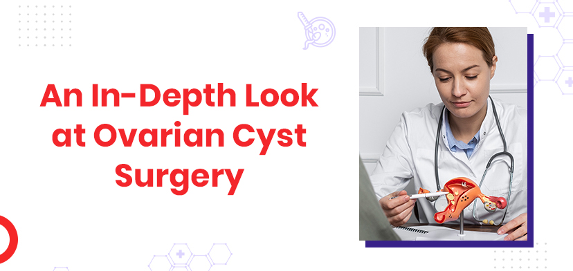 An In-Depth Look At Ovarian Cyst Surgery