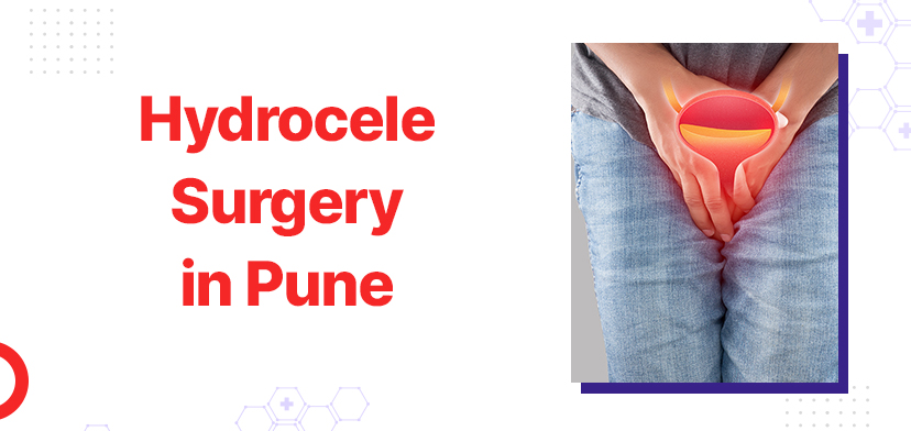 Hydrocele Surgery in Pune