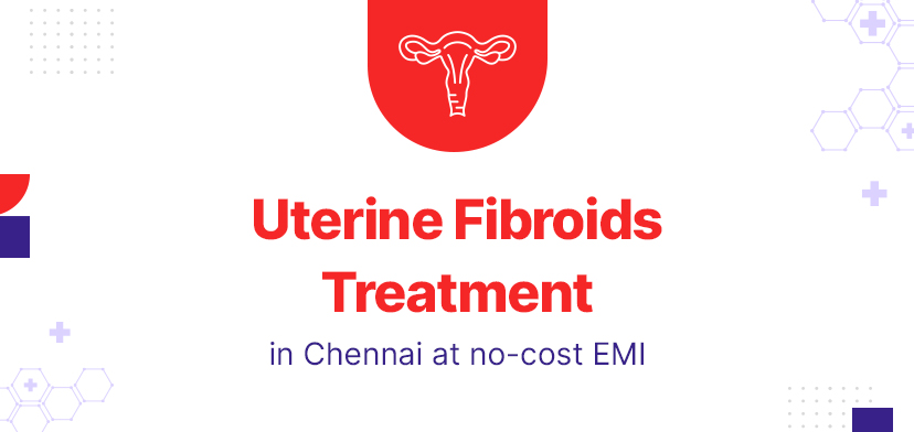 Uterine Fibroids Treatment in Chennai: A Comprehensive Guide