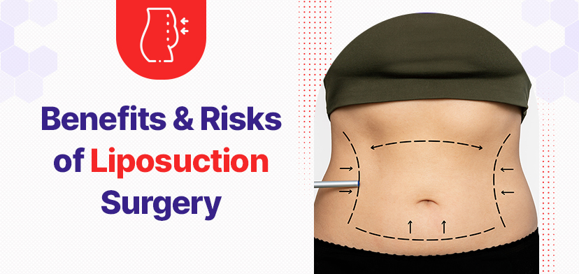 Benefits And Risks of Liposuction Surgery: Guide For Patients In Bengaluru