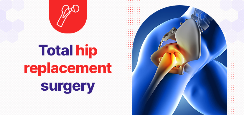 Hip replacement surgery cost in Chennai | Get no-cost EMI with GMoney