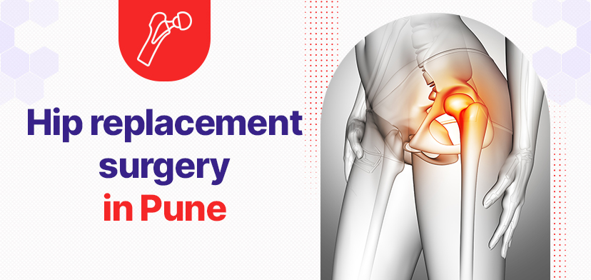 Hip replacement surgery in Pune- Cost, indications for surgery and risk factors