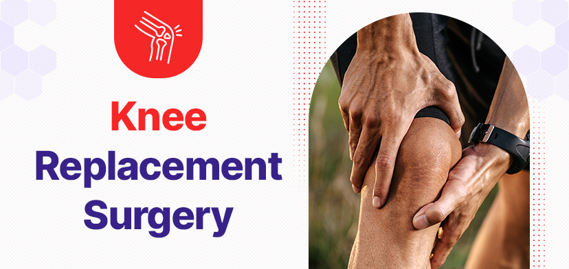 Knee Replacement Surgery