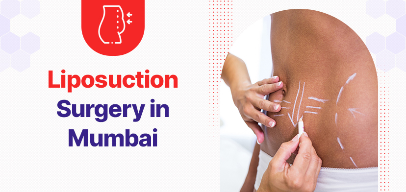 Liposuction Surgery in Mumbai