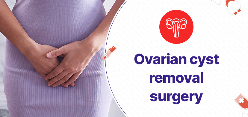 Ovarian Cyst Removal Surgery In Hyderabad: What to expect